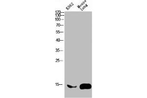 Western blot analysis of mouse-brain mouse-spinal-cord lysate, antibody was diluted at 2000. (FABP2 抗体  (AA 90-132))