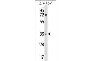 XRCC2 Antibody (N-term) (ABIN1882001 and ABIN2838361) western blot analysis in ZR-75-1 cell line lysates (35 μg/lane). (XRCC2 抗体  (N-Term))