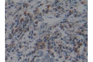 Immunohistochemistry (IHC) image for anti-Angiotensin I Converting Enzyme (Peptidyl-Dipeptidase A) 1 (ACE) (AA 1160-1306) antibody (ABIN7442498)