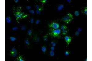 Anti-Nog mouse monoclonal antibody (ABIN2452361) immunofluorescent staining of COS7 cells transiently transfected by pCMV6-ENTRY Nog (RC205020). (NOG 抗体  (AA 28-232))