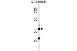 Western Blotting (WB) image for anti-Dehydrogenase/reductase (SDR Family) Member 7 (DHRS7) antibody (ABIN3002129) (DHRS7 抗体)