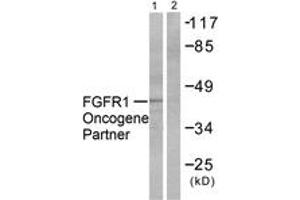 Western blot analysis of extracts from HepG2 cells, using FGFR1 Oncogene Partner Antibody. (FGFR1OP 抗体  (AA 341-390))