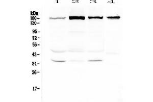 Western blot analysis of IQGAP2 using anti-IQGAP2 antibody . (IQGAP2 抗体  (AA 1329-1544))
