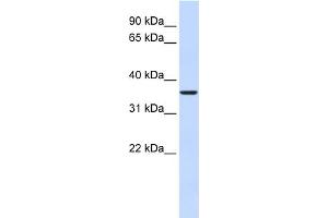 WB Suggested Anti-FBP2 Antibody Titration:  0. (FBP2 抗体  (Middle Region))