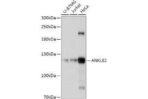Western blot analysis of extracts of various cell lines, using  antibody (ABIN7265603) at 1:1000 dilution. (ANKLE2 抗体  (AA 350-450))