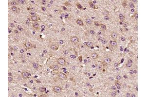 Paraformaldehyde-fixed, paraffin embedded mouse brain, Antigen retrieval by boiling in sodium citrate buffer (pH6) for 15min, Block endogenous peroxidase by 3% hydrogen peroxide for 30 minutes,  Blocking buffer (normal goat serum) at 37°C for 20min, Antibody incubation with HER3 (Tyr1289) Polyclonal Antibody(bs-3491R) at 1:400 overnight at 4°C, followed by a conjugated secondary and DAB staining. (ERBB3 抗体  (pTyr1289))