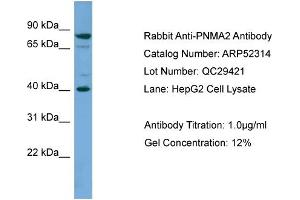 WB Suggested Anti-PNMA2  Antibody Titration: 0. (PNMA2 抗体  (Middle Region))