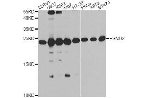 Western blot analysis of extracts of various cell lines, using PSMB2 antibody (ABIN6291444) at 1:1000 dilution. (PSMB2 抗体)