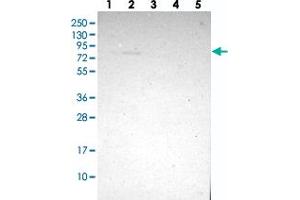 Western blot analysis of Lane 1: RT-4, Lane 2: U-251 MG, Lane 3: Human Plasma, Lane 4: Liver, Lane 5: Tonsil with ZMAT1 polyclonal antibody . (ZMAT1 抗体)