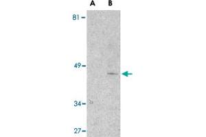 Western blot analysis of Il1rl1 in mouse kidney lysate with Il1rl1 polyclonal antibody  at 1 ug/mL in the presence (lane A) or absence (lane B) of 1 ug blocking peptide. (IL1RL1 抗体  (N-Term))