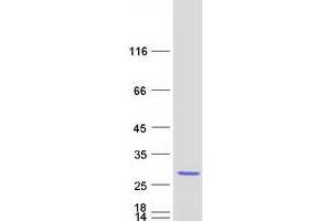 Western Blotting (WB) image for Nucleolar Protein 16 (NOP16) protein (Myc-DYKDDDDK Tag) (ABIN2727466)