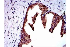 Immunohistochemistry (IHC) image for anti-Neural Precursor Cell Expressed, Developmentally Down-Regulated 8 (NEDD8) antibody (ABIN969547)