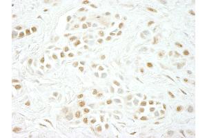 Immunohistochemistry (IHC) image for anti-Cyclin C (CCNC) (AA 244-294) antibody (ABIN7448506) (Cyclin C 抗体  (AA 244-294))