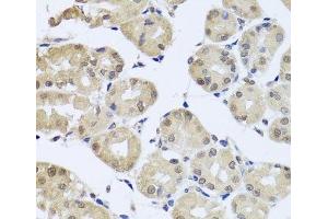Immunohistochemistry of paraffin-embedded Human stomach using CDC45 Polyclonal Antibody at dilution of 1:100 (40x lens). (CDC45 抗体)