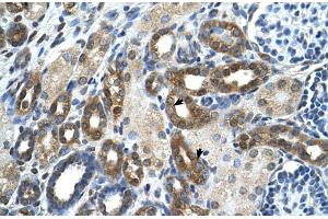 Immunohistochemistry (Paraffin-embedded Sections) (IHC (p)) image for anti-Pyruvate Kinase, Liver and RBC (PKLR) (N-Term) antibody (ABIN2776945)