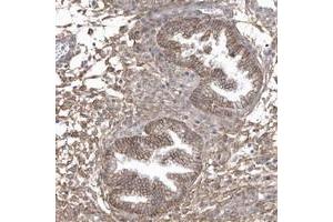 Immunohistochemical staining of human corpus, uterine with CRIP3 polyclonal antibody  shows moderate membranous and cytoplasmic positivity in glandular cells. (CRIP3 抗体)