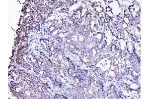 IHC analysis of cortactin using anti-cortactin antibody (ABIN6719306). (Cortactin 抗体  (AA 1-105))
