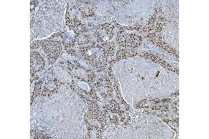 IHC analysis of TRMT6 using anti-TRMT6 antibody (ABIN7602138). (TRMT6 抗体  (AA 6-489))