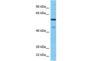 Host:  Rabbit  Target Name:  NEK11  Sample Type:  721_B Whole Cell lysates  Antibody Dilution:  1. (NEK11 抗体  (Middle Region))