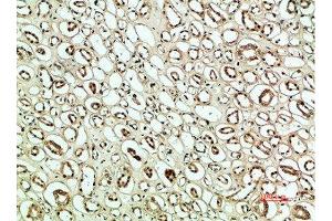 Immunohistochemical analysis of paraffin-embedded human-kidney, antibody was diluted at 1:200 (PLK2 抗体  (AA 1268-1341))