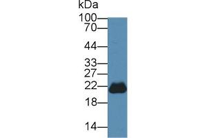 Western blot analysis of Mouse Cerebrum lysate, using Mouse PEBP1 Antibody (3 µg/ml) and HRP-conjugated Goat Anti-Rabbit antibody ( (PEBP1 抗体  (AA 2-187))