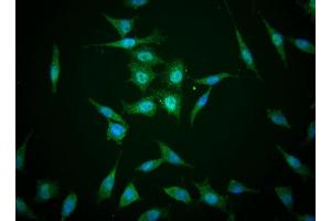 Immunofluorescent staining of human cell lines (TAZ 抗体)