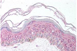 Human Skin (formalin-fixed, paraffin-embedded) stained with MDH1 antibody ABIN291679 at 5 ug/ml followed by biotinylated secondary antibody, alkaline phosphatase-streptavidin and chromogen. (MDH1 抗体)