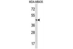 RNH1 Antibody (C-term) western blot analysis in MDA-MB435 cell line lysates (35µg/lane). (RNH1 抗体  (C-Term))