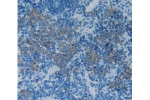 Used in DAB staining on fromalin fixed paraffin- embedded Kidney tissue (IL-2 抗体  (AA 21-155))