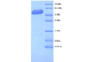 Mannose-6-Phosphate Receptor (Cation Dependent) (M6PR) (AA 1-277), (full length) protein (GST tag) (M6PR Protein (AA 1-277, full length) (GST tag))