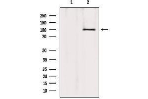 Western blot analysis of extracts from 293, using ATP2A1 Antibody. (ATP2A1/SERCA1 抗体  (Internal Region))