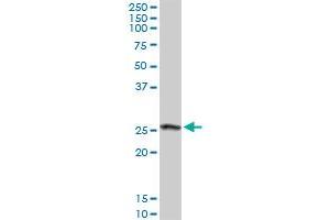 CLIC3 MaxPab rabbit polyclonal antibody. (CLIC3 抗体  (AA 1-236))