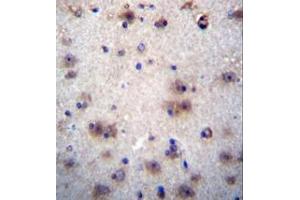 Formalin fixed and paraffin embedded human brain tissue reacted with EVPLL Antibody (Center) followed by peroxidase conjugation of the secondary antibody and DAB staining. (Envoplakin-Like 抗体  (Middle Region))