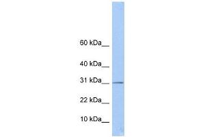 ECHDC1 antibody used at 1 ug/ml to detect target protein. (ECHDC1 抗体  (Middle Region))