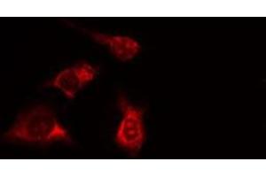 ABIN6277996 staining HeLa cells by IF/ICC. (SPTAN1 抗体  (N-Term))