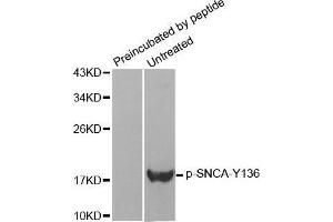 Western Blotting (WB) image for anti-Synuclein, alpha (SNCA) (pTyr136) antibody (ABIN1682064) (SNCA 抗体  (pTyr136))