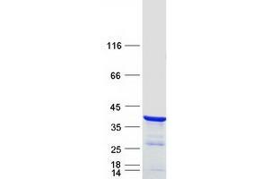 Western Blotting (WB) image for Nuclear Receptor Interacting Protein 3 (NRIP3) protein (Myc-DYKDDDDK Tag) (ABIN2727635)