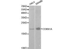Western blot analysis of extracts of various cell lines, using CDKN1A antibody. (p21 抗体  (AA 43-142))