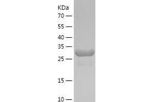 Western Blotting (WB) image for PSME3 (PSME3) (AA 2-254) protein (His tag) (ABIN7124704) (PSME3 Protein (PSME3) (AA 2-254) (His tag))