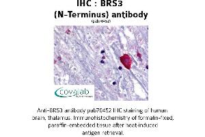 Image no. 1 for anti-Bombesin-Like Receptor 3 (BRS3) (Extracellular Domain), (N-Term) antibody (ABIN1732420) (BRS3 抗体  (Extracellular Domain, N-Term))