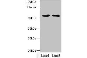 Western blot All lanes: SLC30A1 antibody at 3. (SLC3A1 抗体  (AA 328-507))