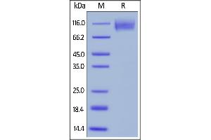 Biotinylated Human CEACAM-5, His,Avitag on  under reducing (R) condition. (CEACAM5 Protein (AA 35-685) (His tag,AVI tag,Biotin))