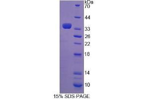 SDS-PAGE analysis of Mouse TGM3 Protein. (TGM3 蛋白)