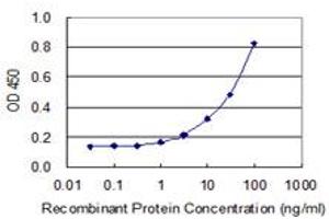 Detection limit for recombinant GST tagged ZNF155 is 0. (ZNF155 抗体  (AA 422-520))