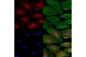 Phospho-SIRT6 (Ser338) Antibody staining A549 cells(4h of LPS treatment) by IF/ICC. (SIRT6 抗体  (pSer338))