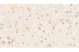 Immunohistochemistry (IHC) image for anti-Retinol Binding Protein 2, Cellular (RBP2) (AA 1-134) antibody (ABIN7429292)
