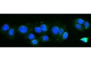 IF analysis of TTC11/FIS1 using anti-TTC11/FIS1 antibody (ABIN7600321).