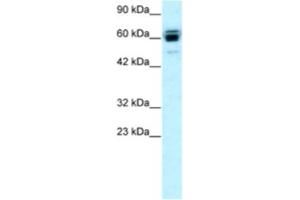 Western Blotting (WB) image for anti-Ring Finger Protein, LIM Domain Interacting (RLIM) antibody (ABIN2460384) (RLIM 抗体)