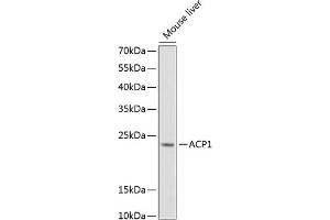 Western blot analysis of extracts of mouse liver, using  Antibody (ABIN6127321, ABIN6136446, ABIN6136448 and ABIN6216005) at 1:1000 dilution. (ACP1 抗体  (AA 1-158))