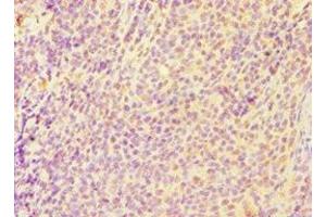 Immunohistochemistry of paraffin-embedded human tonsil tissue using ABIN7146954 at dilution of 1:100 (Caspase 6 抗体  (AA 24-293))